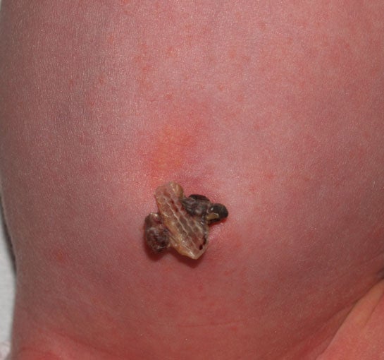 umbilicus dried.jpg